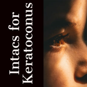 Intacs for Keratoconus