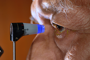 Man being tested for Glaucoma